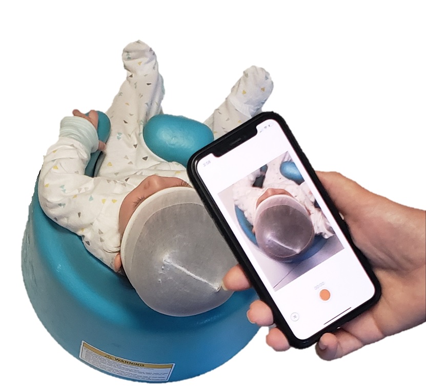 PediaMetrix Inc. creates first FDA-cleared smartphone app for infant cranial measurements